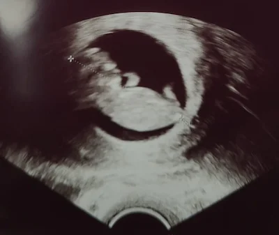 Celebrate the first big milestone of your journey as you see your baby’s growth and prepare for the exciting road ahead.